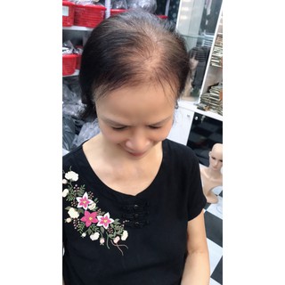 Mái hói tóc thật 100 %