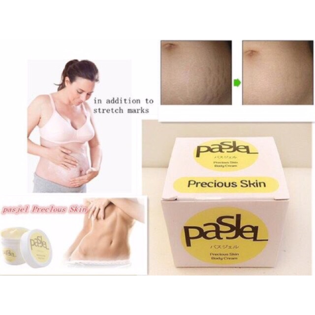 Kem trị rạn da PasJel Thái Lan