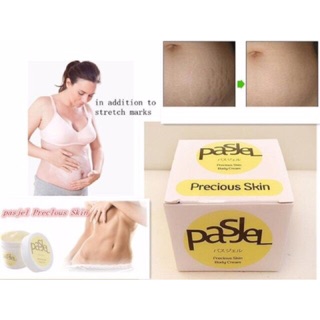 Kem trị rạn da PasJel Thái Lan
