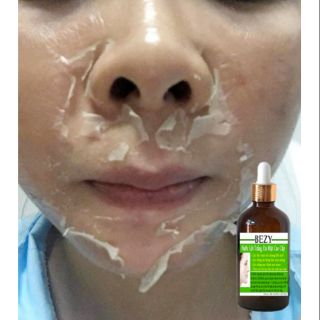 Piu Da Xóa Nám Sạm