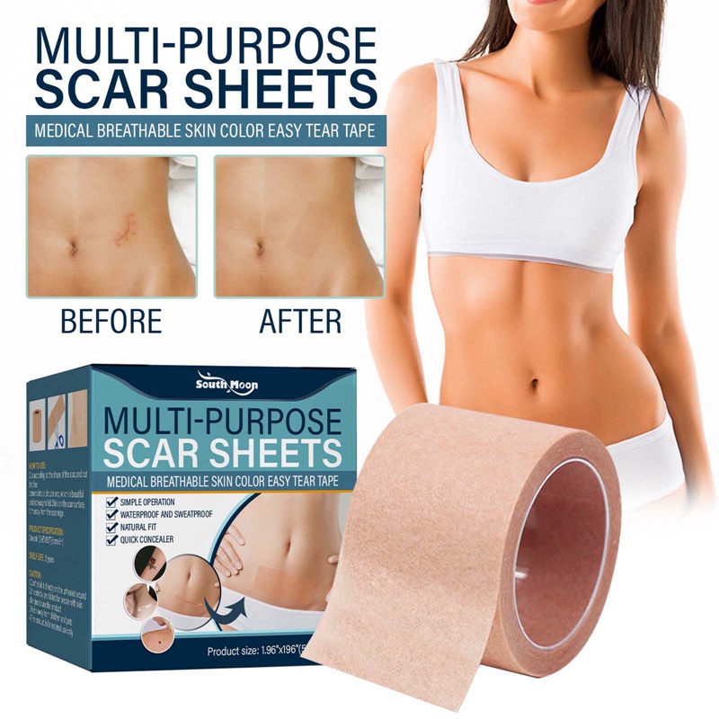 Kem Hỗ trợ giảm sẹo Vải Không Dệt Chuyên Nghiệp