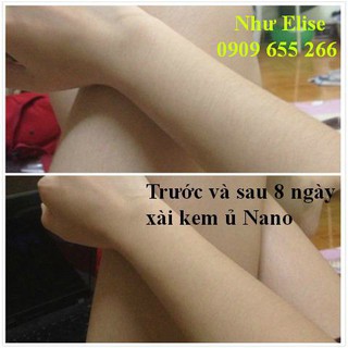 KEM Ủ NANO