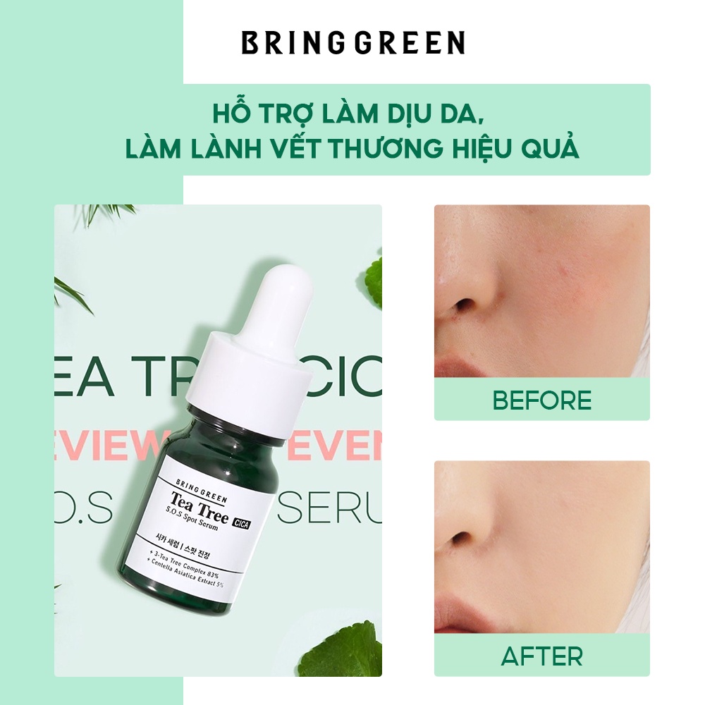 Tinh Chất Chấm Mụn Tràm Trà Bring Green Tea Tree Cica SOS Spot Serum 13ml (FOC Spot Patch)