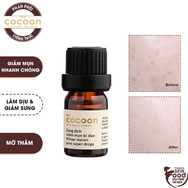 Dung Dịch Chấm Mụn, Hỗ Trợ Giảm Mụn Chiết Xuất Bí Đao The Cocoon Winter Melon Acne Super Drops 5ml