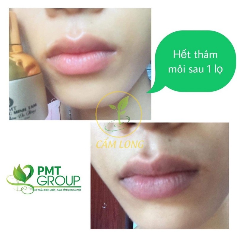 Kem Giảm Mờ Thâm Đầu Gối Nách Môi Vùng Kín Bikini Sẹo PHÚC MINH TÂM MTPMTTD46 Dưỡng Ẩm Bổ Sung Dưỡng Chất Làm Mờ Thâm | BigBuy360 - bigbuy360.vn