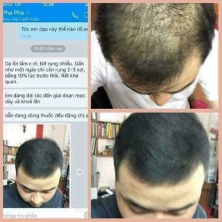 Combo dầu gội bưởi ( lọ to ) + xịt tóc tinh dầu bưởi