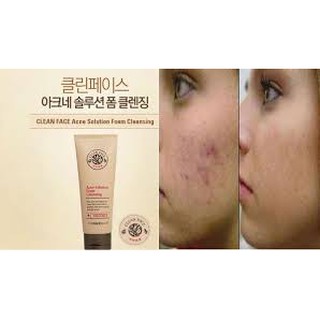 Sữa rửa mặt Clean Face Acne Solution Foam Cleansing