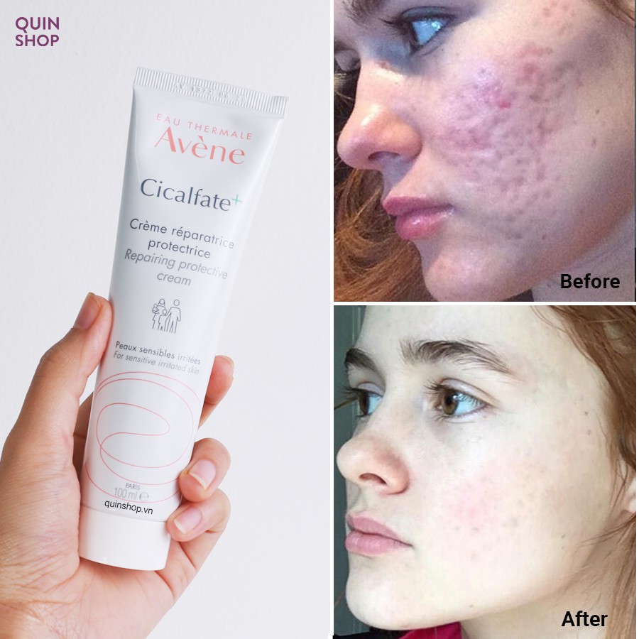 Kem Dưỡng Làm Dịu Da Avene Cicalfate+ Repairing Protective Cream