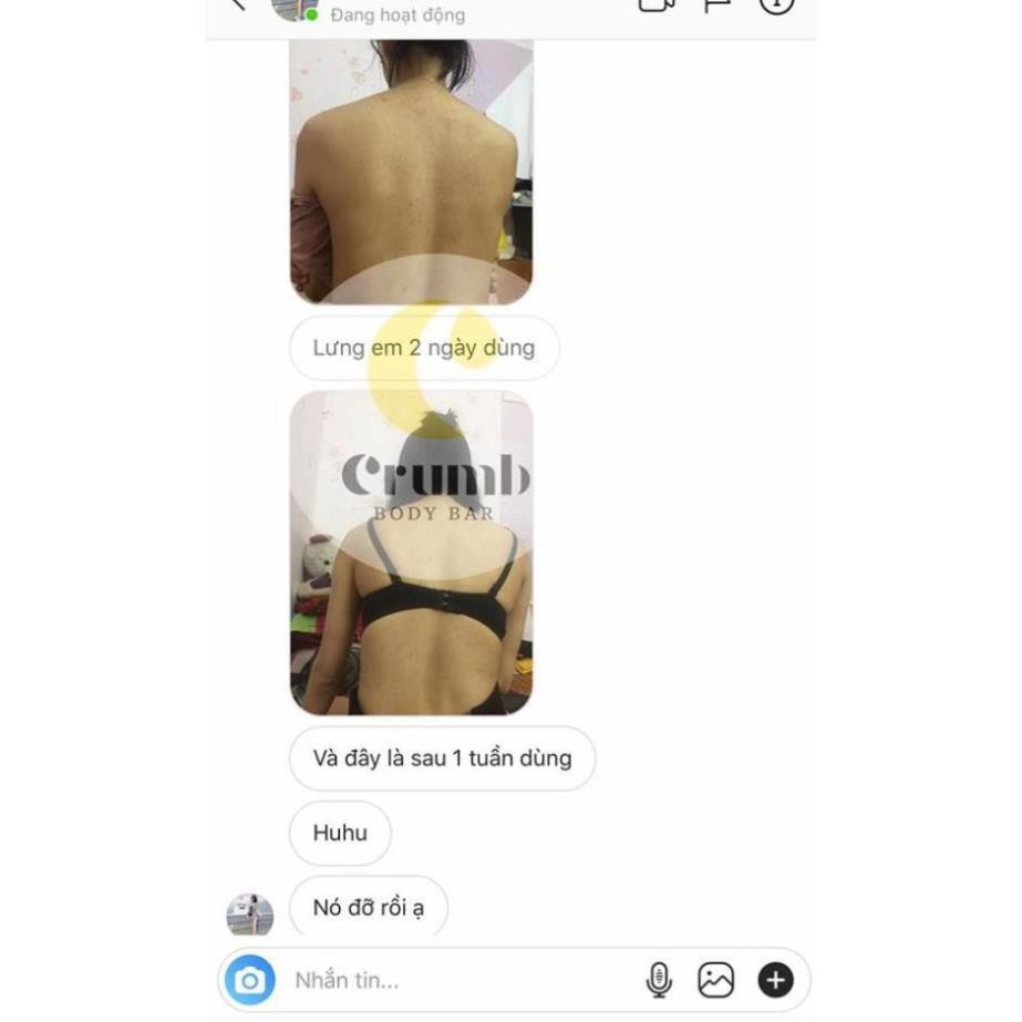 Crum Body - Kháng bỏ mụn lưng - Viêm nang lông