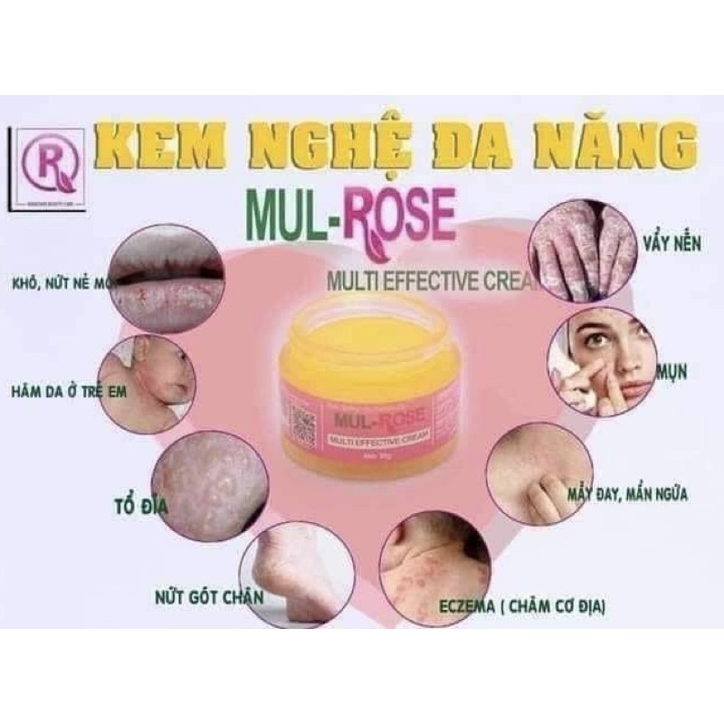 Kem Nghệ Đa Năng Mul-Rose - Chính Hãng 100%