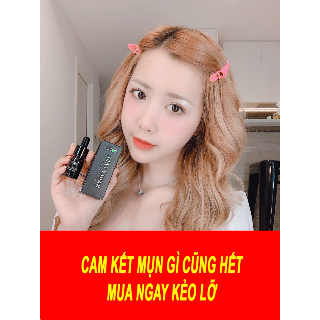 SERUM MỤN NANCY CARE HẾT MỤN, MỜ THÂM, GIÚP DA TRẮNG SÁNG, MỊN MÀNG HƠN | BigBuy360 - bigbuy360.vn
