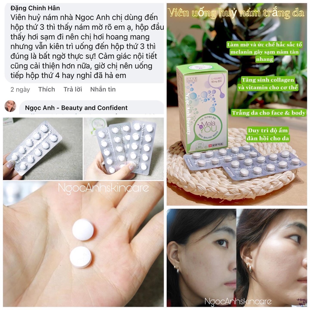 Viên Uống Trắng Da, Viên Uống Huỷ Nám Tàn Nhang Melaforyou Ngăn Ngừa Lão Hóa Ức Chế Nếp Nhăn Bật Tone Căng Hồng Hào