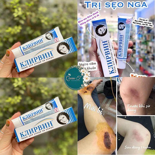 Kem mờ sẹo Nga [CHÍNH HÃNG 100%] - Tuýp 25g - Mờ các loại sẹo, rỗ, thâm, nám hãy kiên trì sau 2 tháng để thấy hiệu quả