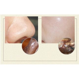 Gel lột mụn Organic