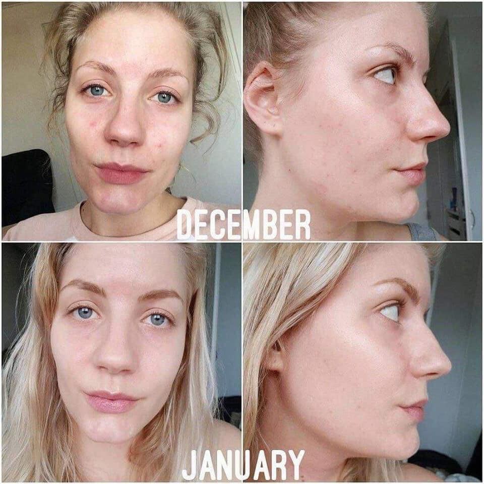 Serum Niacinamide The Ordinary