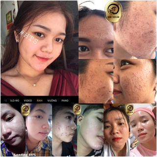 Combo Bọt rửa mặt & Serum Hoàng Thiên Sâm dưỡng da