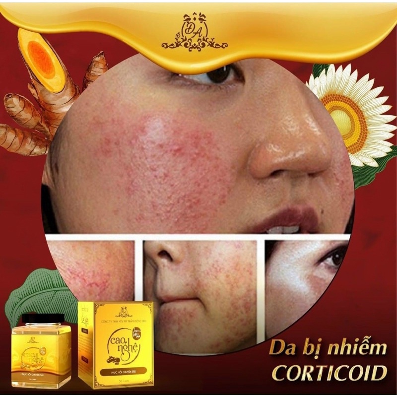 [CHÍNH HÃNG] Cao Nghệ Collagen X3