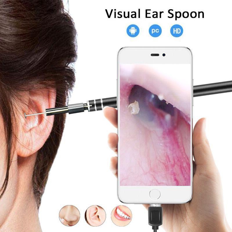 Máy Hỗ Trợ Lấy Ráy Tai Xịn-Camera Nội Soi Tai Siêu Nét Kèm Bộ Lấy Ráy Mũi chuyên nghiệp - Nhanh gọn - Không đau