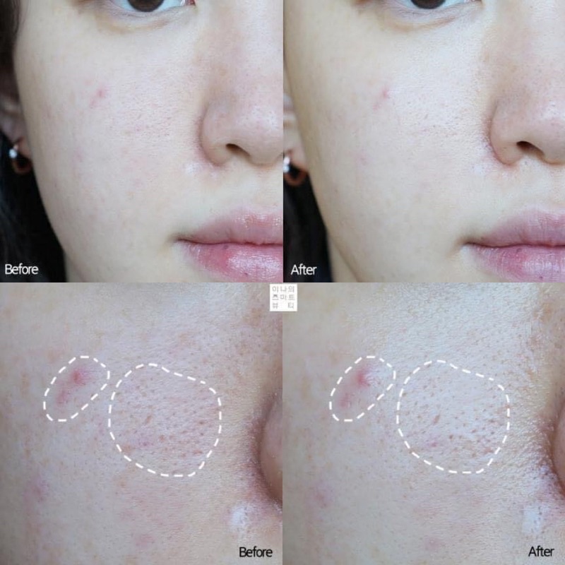 [FREE SHIP] TONER KHÔNG MÙI KLAIRS CHO DA NHẠY CẢM