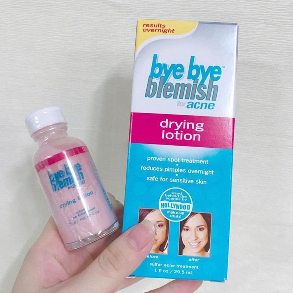 Kem Chấm Mụn Bye Bye Blemish Drying Lotion 30ml