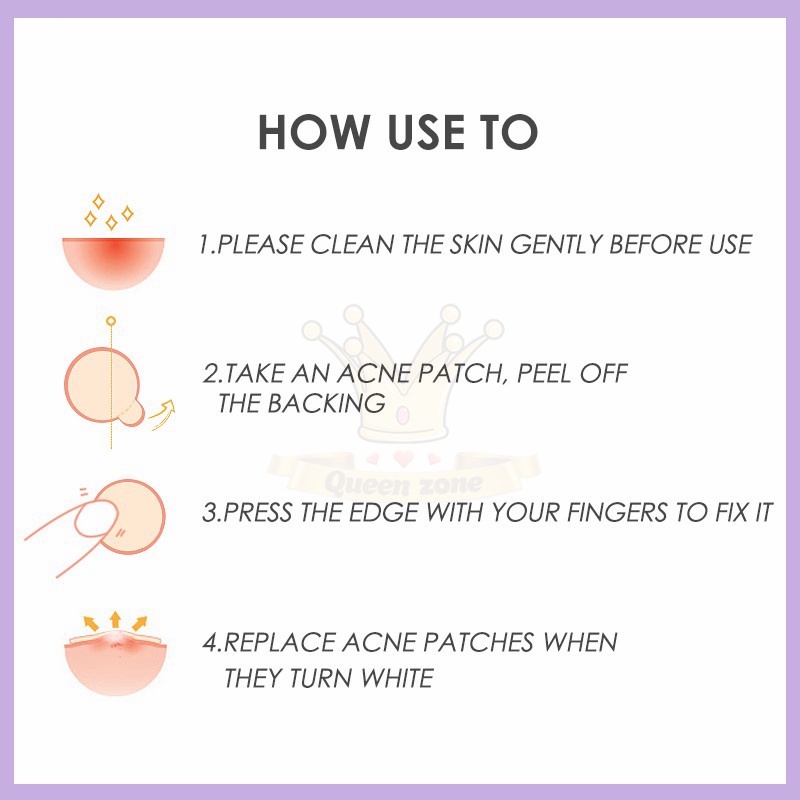 Set 36 Miếng Dán Hỗ Trợ Giảm Mụn Vô Hình Tiện Dụng Miếng Dán Hỗ Trợ Cải Thiện Mụn Kiểm Soát Dầu Không Thấm Nước