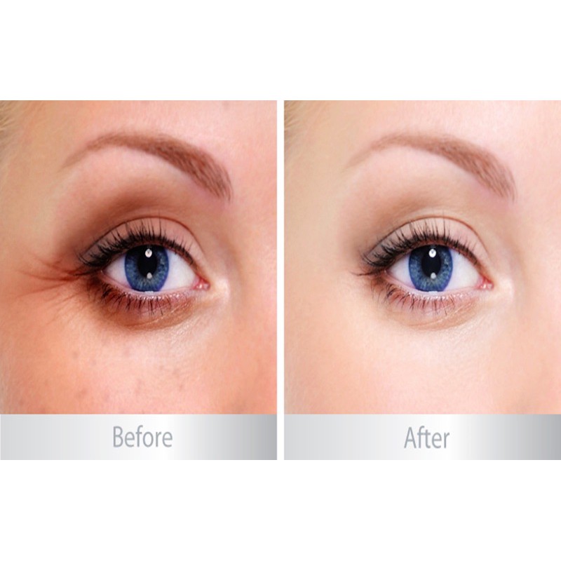 Kem dưỡng mắt Balance Active Formula Snake Venom Eye Cream | BigBuy360 - bigbuy360.vn