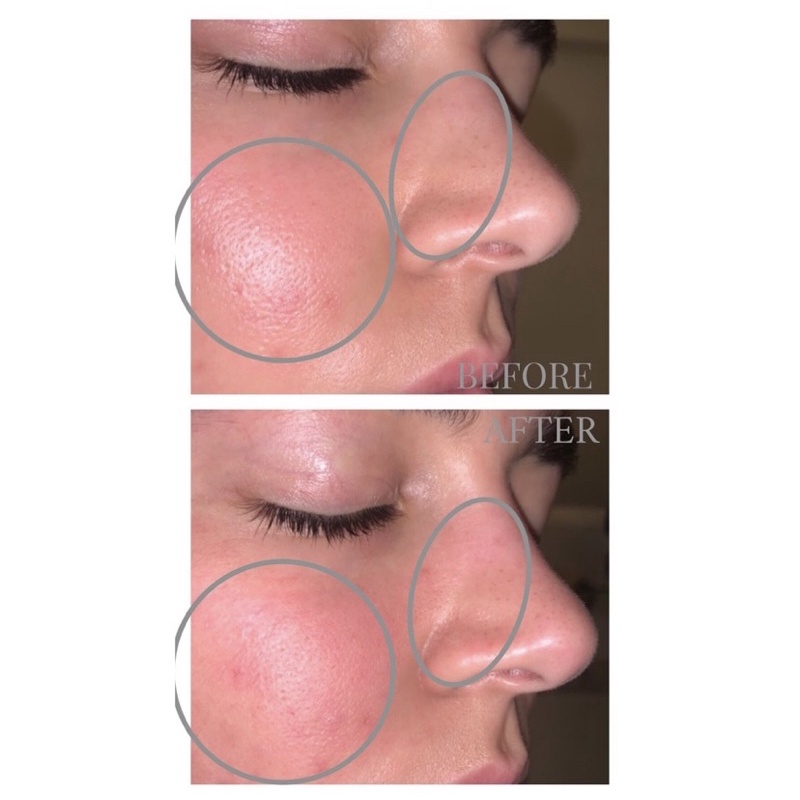 Mặt nạ thải độc làm sạch lcl GLAMGLOW supermud clearing treatment - CHÍNH HÃNG