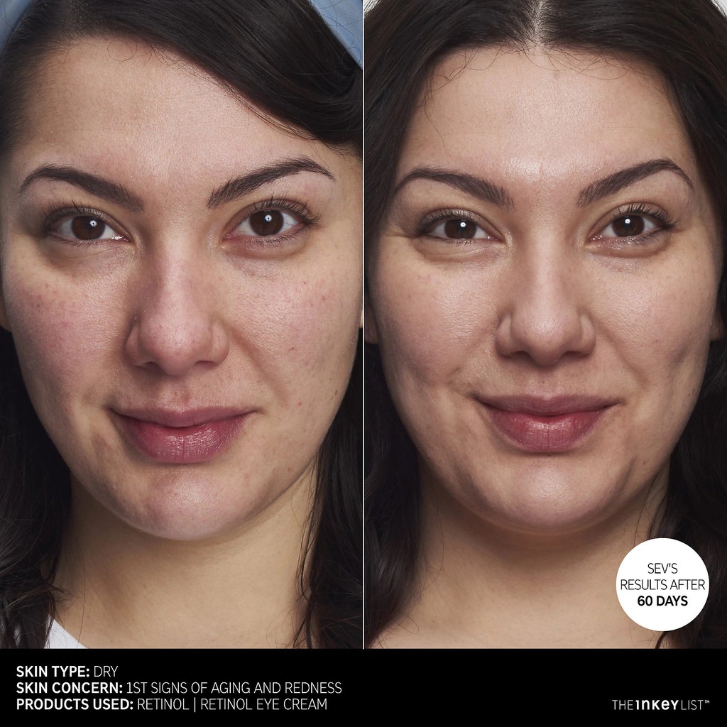 [BILL SEPHORA] ❤️FREESHIP❤️ SERUM CHỐNG LÃO HÓA, HỖ TRỢ GIẢM MỤN, TÁI TẠO DA RETINOL THE INKEY LIST | BigBuy360 - bigbuy360.vn