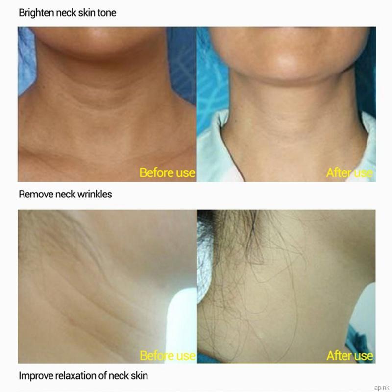 Kem dưỡng da vùng cổ chống lão hóa + nếp nhăn làm trắng nâng chắc Soonpure