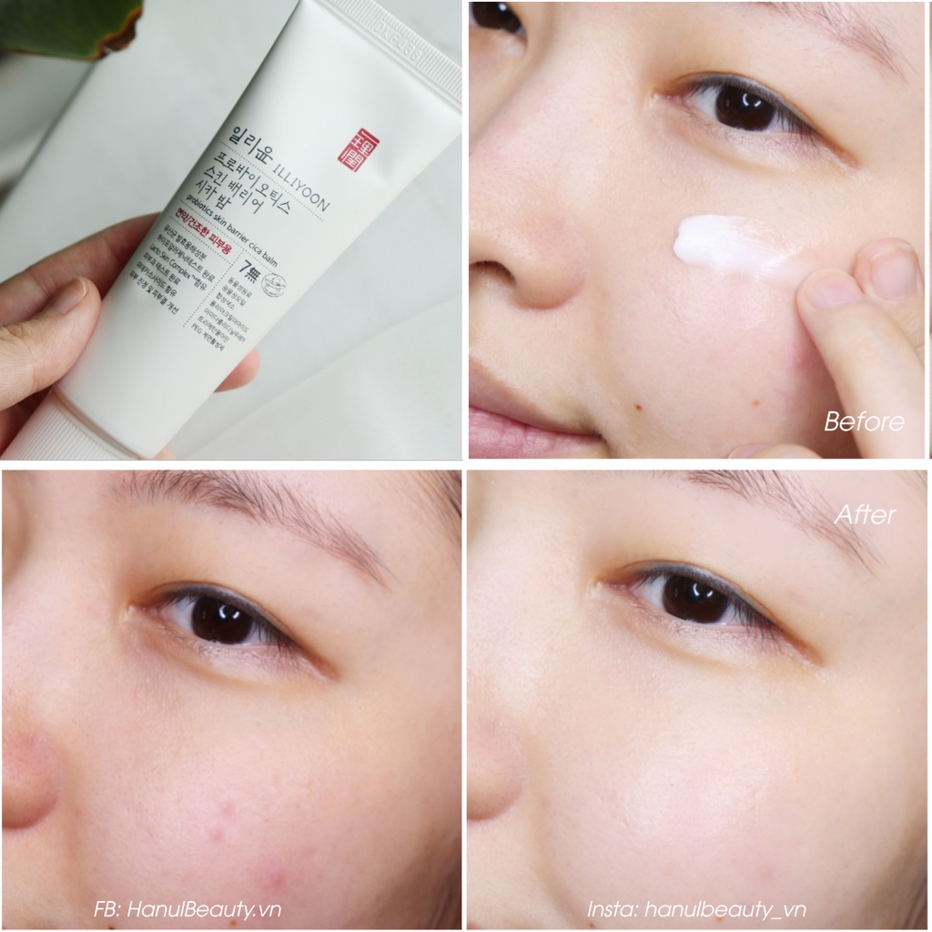 ILLIYOON dưỡng ẩm trắng da tính chất men vi sinh Probiotics Skin Barrier Essence Drop Set chính hãng