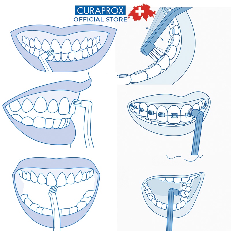 Bộ sản phẩm vệ sinh răng niềng Curaprox Ortho Kit Thụy Sĩ có chỉ