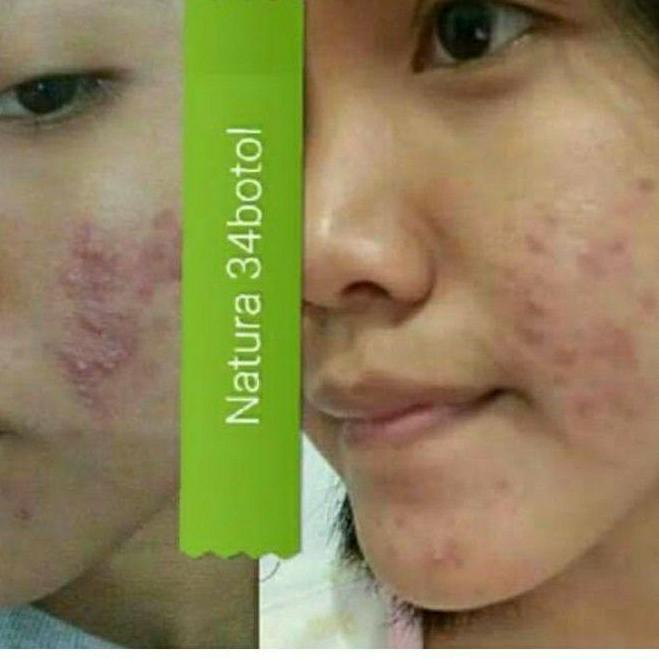 Cái thứ hai này! Tấm trải giường phun sương làm đẹp Lr075 Natura NBS Beuty Biuty Sprey Natura | BigBuy360 - bigbuy360.vn