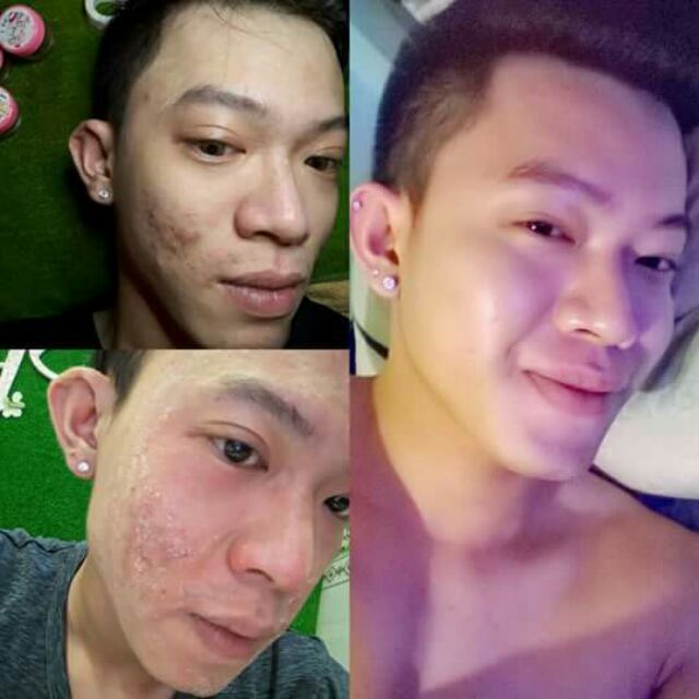 Thảo dược Mộc Linh Chi