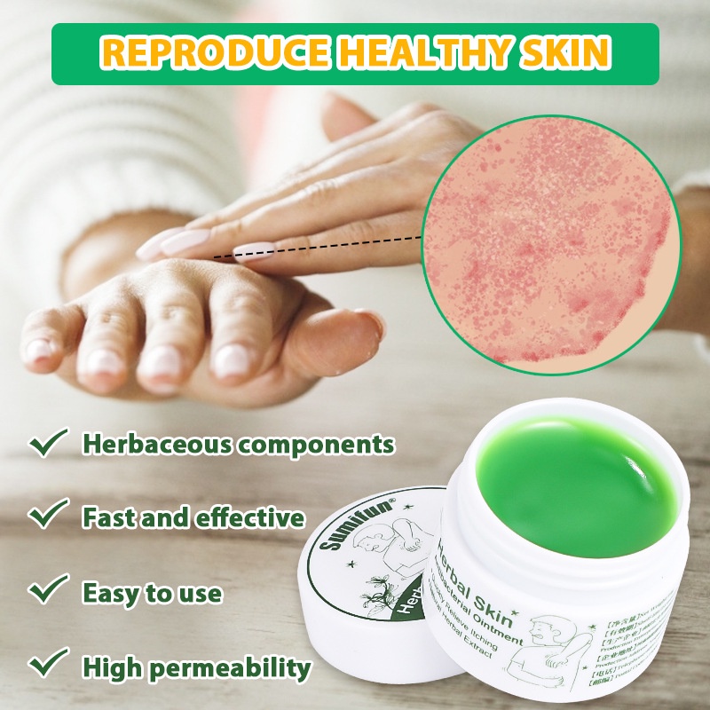 Kem bôi ngứa, người lớn, trẻ em, tinh chất thảo dược thiên nhiên