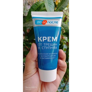 Kem trị nứt gót chân