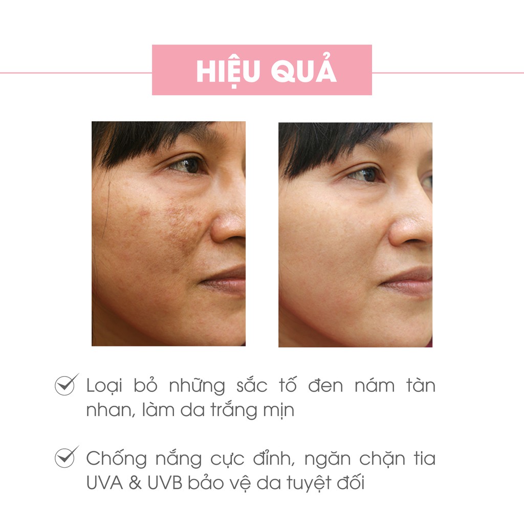 Bộ sản phẩm làm mờ nám da mặt Truesky V01 gồm 1 kem giảm nám da Melasma Cream 15g và một sữa rửa mặt nha đam 60ml | BigBuy360 - bigbuy360.vn