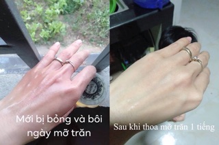 Mỡ trăn nguyên chất 100%