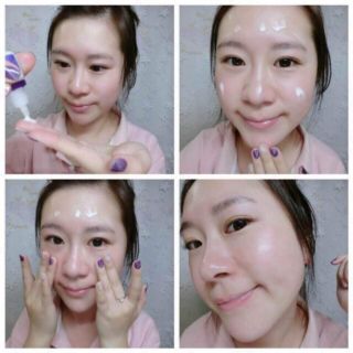 Tế bào gốc cuống RỐN DMT