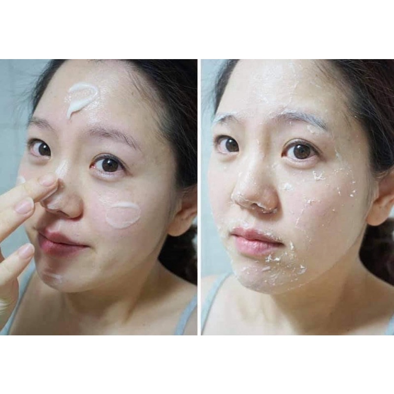 Tẩy da chết Dr.G