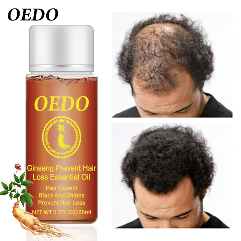 Dung dịch dưỡng tóc OEDO có thành phần nhân sâm ngăn ngừa rụng tóc giúp mọc và phục hồi tóc hư tổn