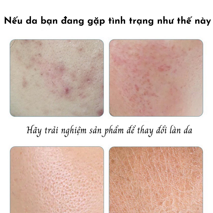 Mặt nạ quả bơ cấp ẩm mờ thâm, mặt nạ dưỡng da làm da mềm mịn cải thiện làn da khoẻ mạnh nội địa trung Lyyoga-A65