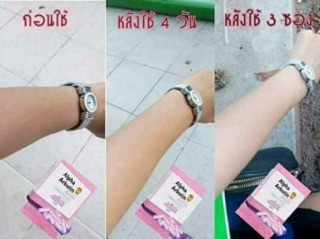 Dưỡng trắng da Lotion Alpha arbutin