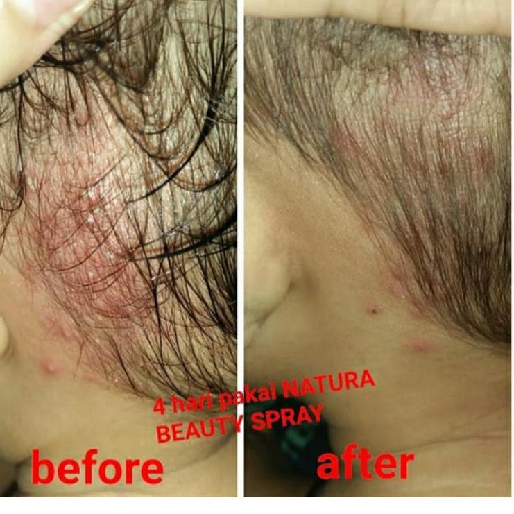 Bình Xịt Làm Đẹp Tự Nhiên 100%EF39 (Trims,.) | BigBuy360 - bigbuy360.vn