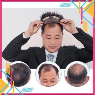 [Sale15%]  Tóc giả che hói nam