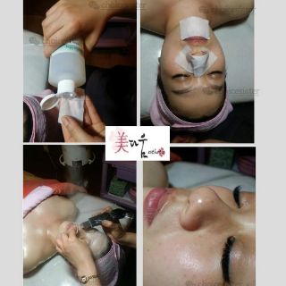 SIÊU Ủ MỤN CỦA MĨ SUPER X LOTION 1LÍT