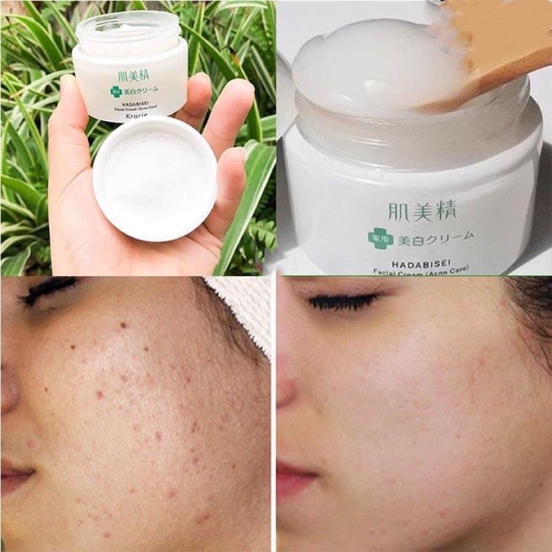 Kem ngăn ngừa mụn và dưỡng trắng KRACIE HADABISE