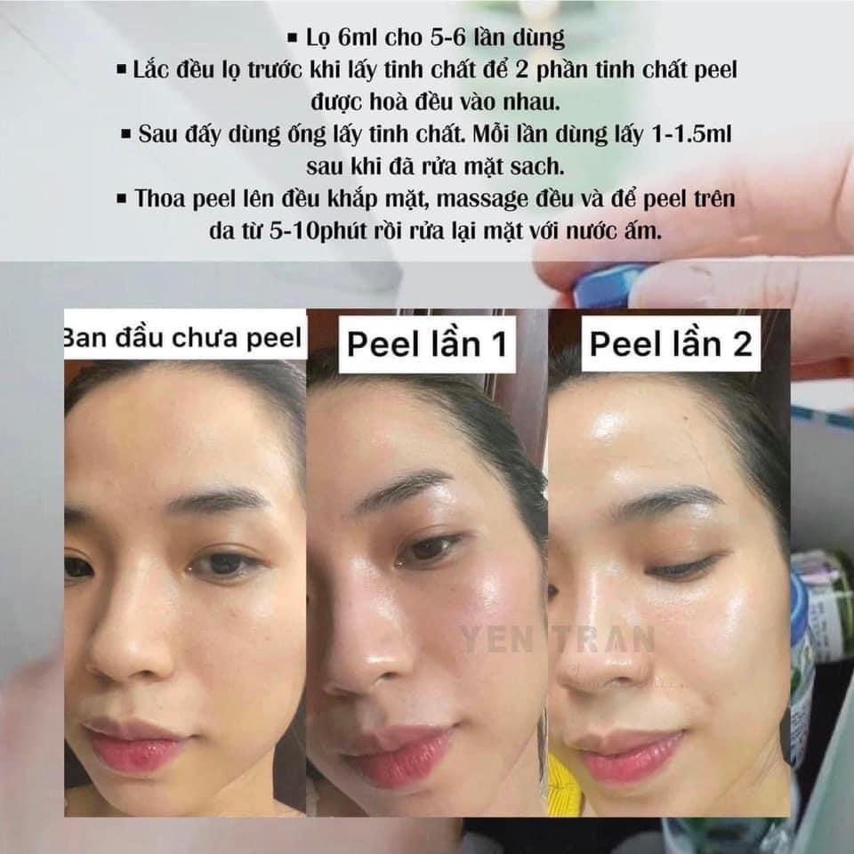 Peel da Bio-repeelcl3 da căng bóng