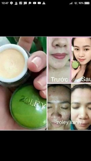 Kem Zoley Xanh 10g_Ngừa Mụn,Vết Thâm,Dưỡng Trắng Da