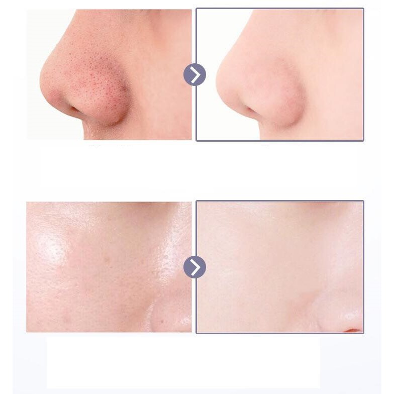 Mặt Nạ Bùn 2 Ngăn Kiềm Dầu Se Chân Lông Dưỡng Cấp Ẩm Sáng Mịn Da