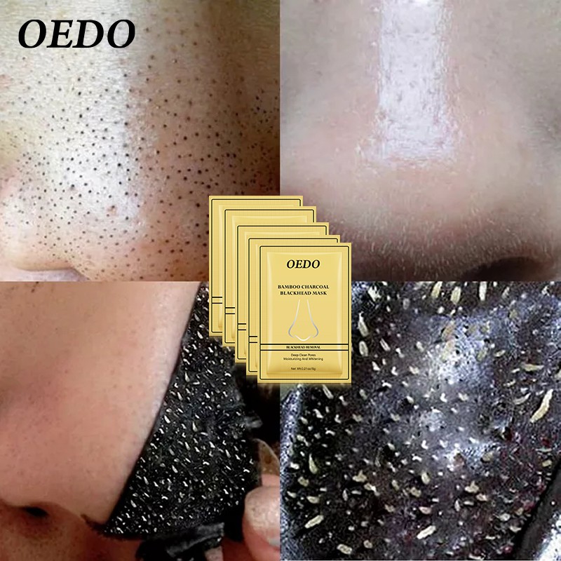 Bộ 5 miếng mặt nạ lột mụn đầu đen OEDO chăm sóc gia